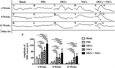 Combined Transplantation of Olfactory Ensheathing Cells With Rat Neural Stem Cells Enhanced the Therapeutic Effect in the Retina of RCS Rats